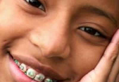 Braces200_1.jpg